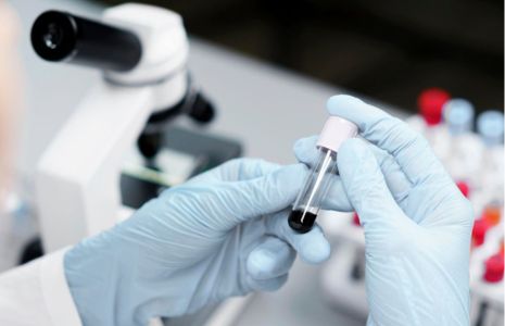 Trajtimi i HIV-it me ndihmën  e qelizave staminale