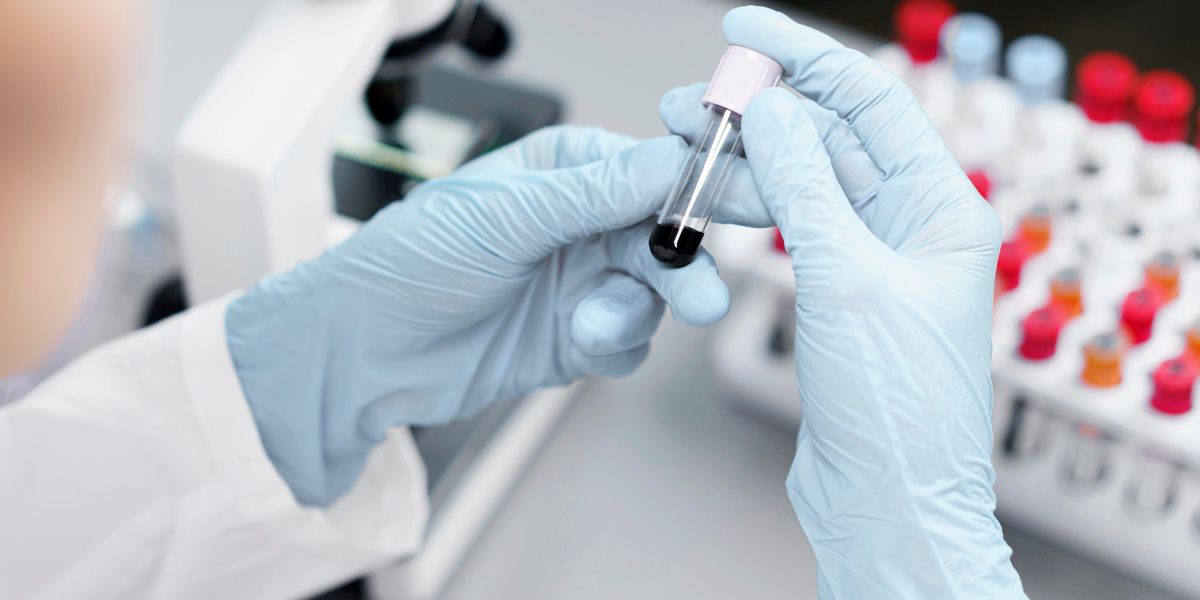 Trajtimi i HIV-it me ndihm&euml;n&nbsp; e qelizave staminale
